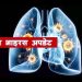 कोरोनाको सङ्क्रमण अपडेट: १ सय १९ देशमा संक्रमण, ४ हजार ३ सयको मृत्यु, ६६ हजार डिस्चार्ज !